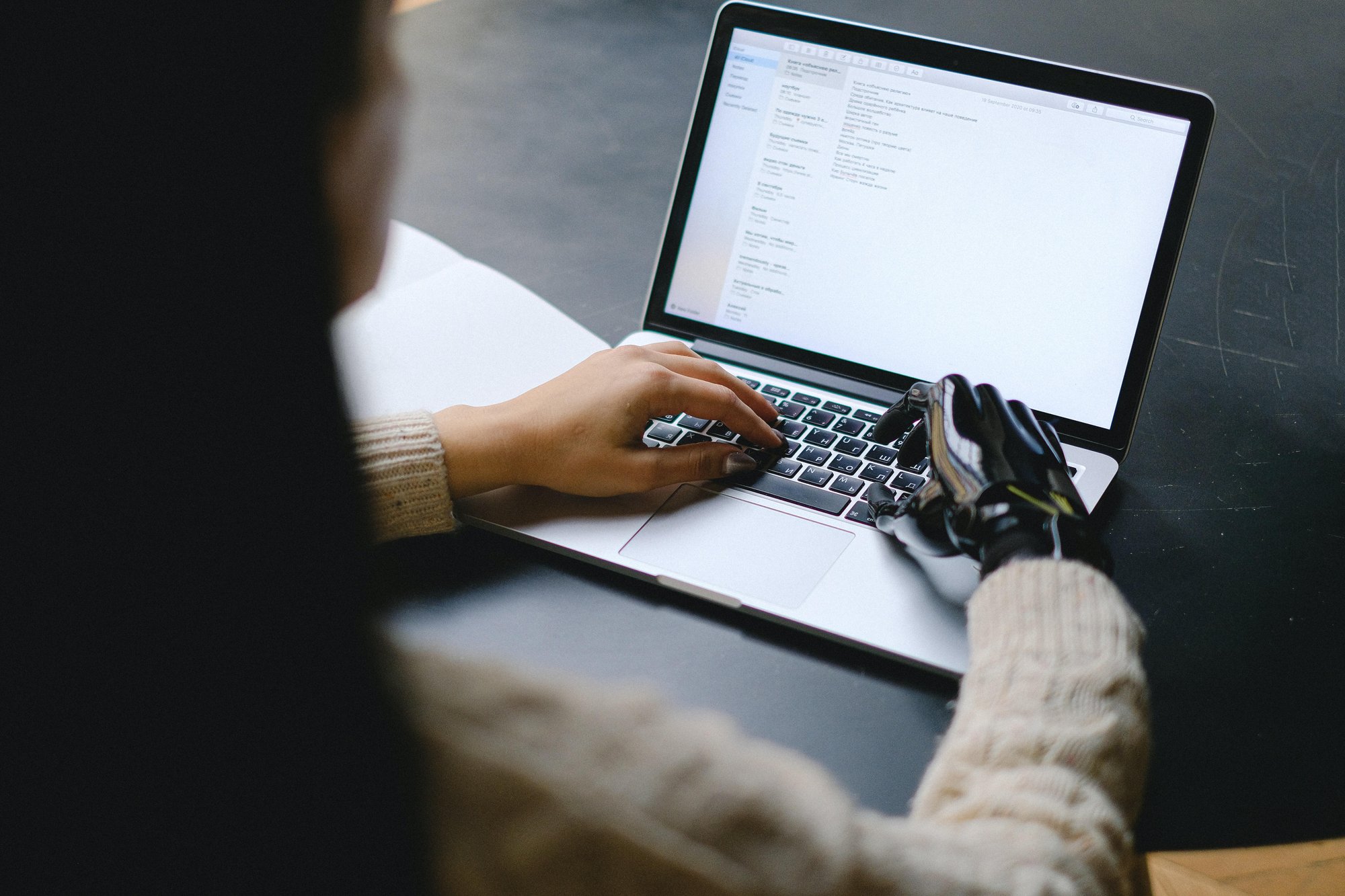 A woman with a robotic hand navigated a laptop. A woman with a robotic hand navigated a laptop.